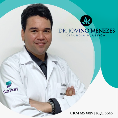 JOVINO MENEZES