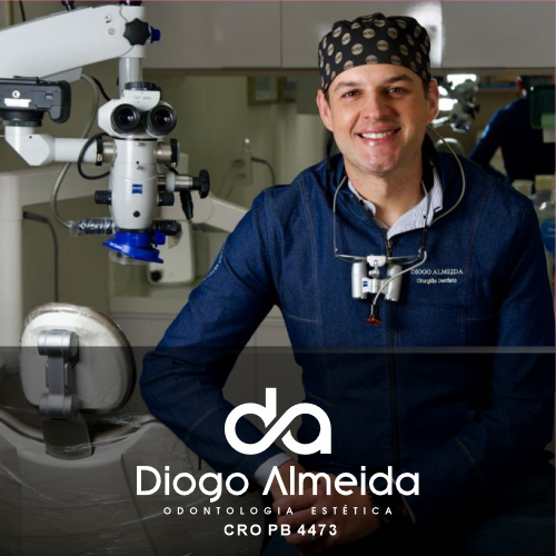DIOGO ALMEIDA