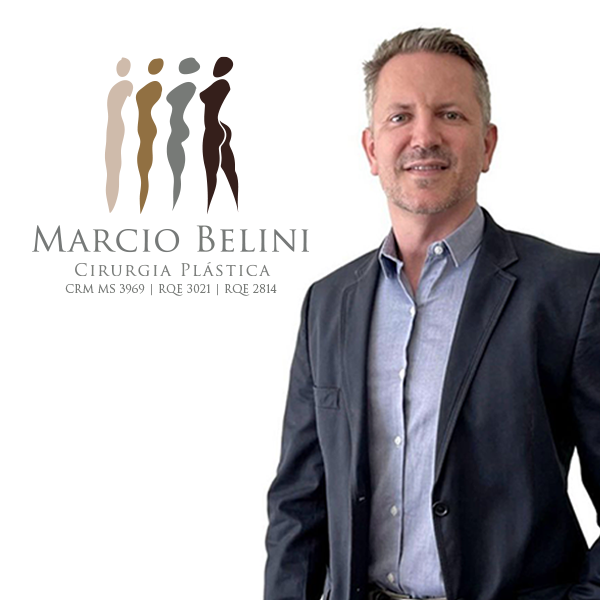 MARCIO BELINI