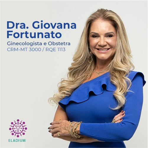 GIOVANA FORTUNATO