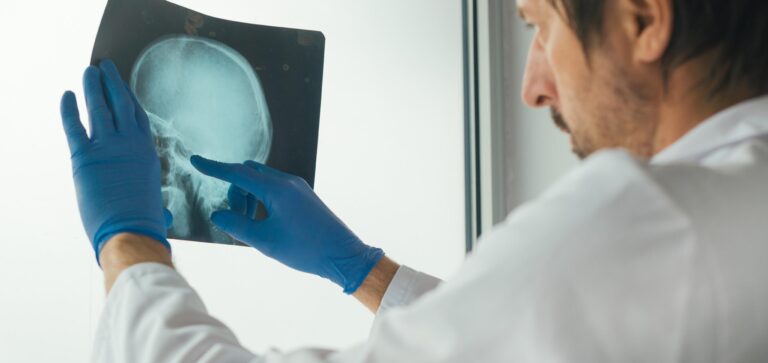 Neurologista em Campo Grande MS
