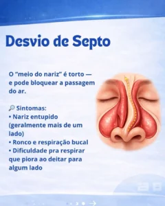 Dr. Vitor Arrais, médico otorrinolaringologista em Recife especialista em problemas nasais, respiração e distúrbios do sono para adultos e crianças.