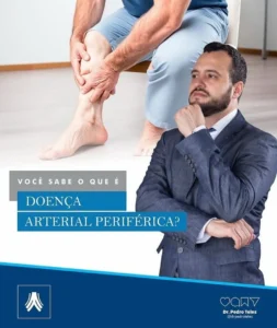 Dr. Pedro Teles, especialista em Cirurgia Vascular, prevenção, diagnóstico e tratamento de doenças vasculares em Goiânia G
