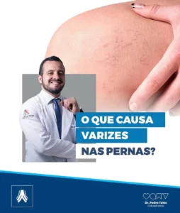 Dr. Pedro Teles, especialista em Cirurgia Vascular, prevenção, diagnóstico e tratamento de doenças vasculares em Goiânia G