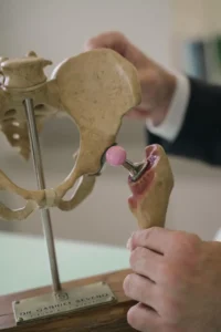 Dr. Gabriel Severo, cirurgião de quadril especialista em vídeo artroscopia para tratamento minimamente invasivo em Porto Alegre.