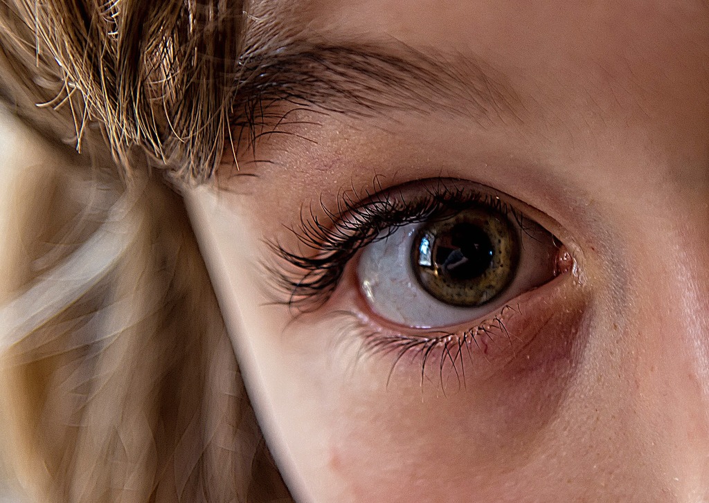 exames para glaucoma: Olho de uma menina.
