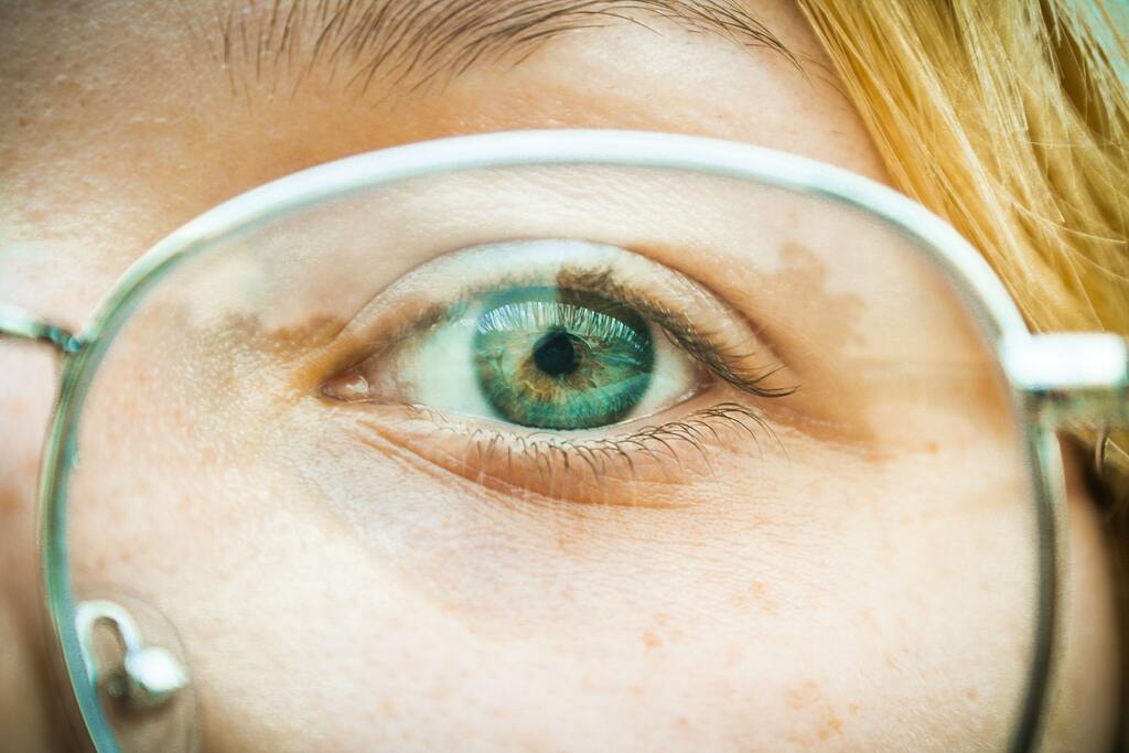 Retinopatia diabética